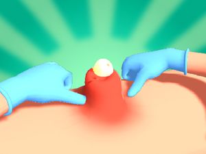 Leikur Pimple kreista á netinu